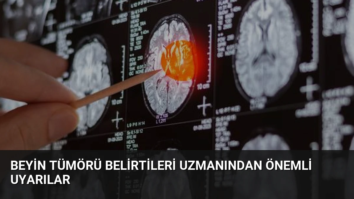 Beyin Tümörü Belirtileri Uzmanından Önemli Uyarılar