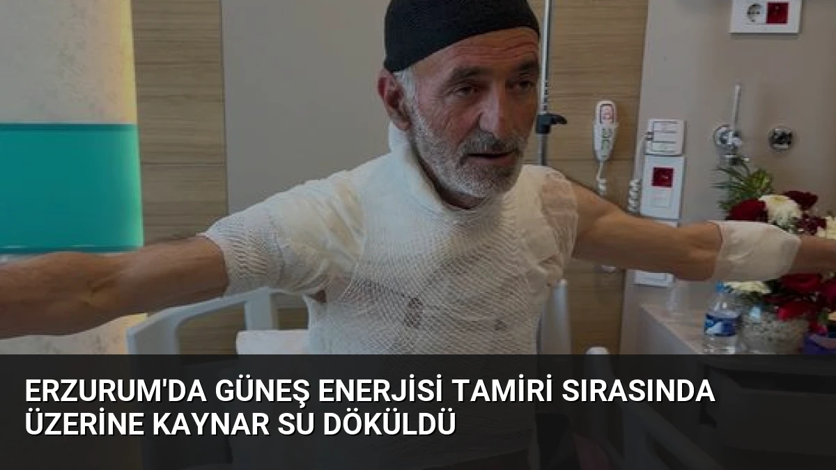 Erzurum’da Güneş Enerjisi Tamiri Sırasında Üzerine Kaynar Su Döküldü