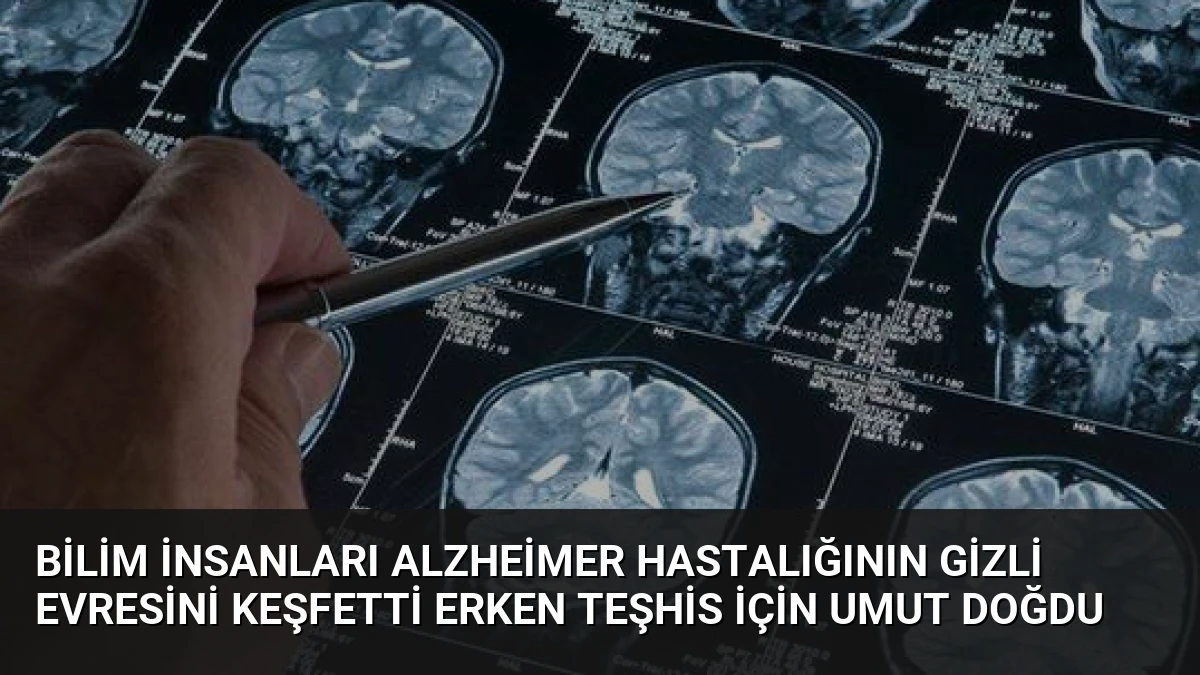 Bilim İnsanları Alzheimer Hastalığının Gizli Evresini Keşfetti Erken Teşhis İçin Umut Doğdu