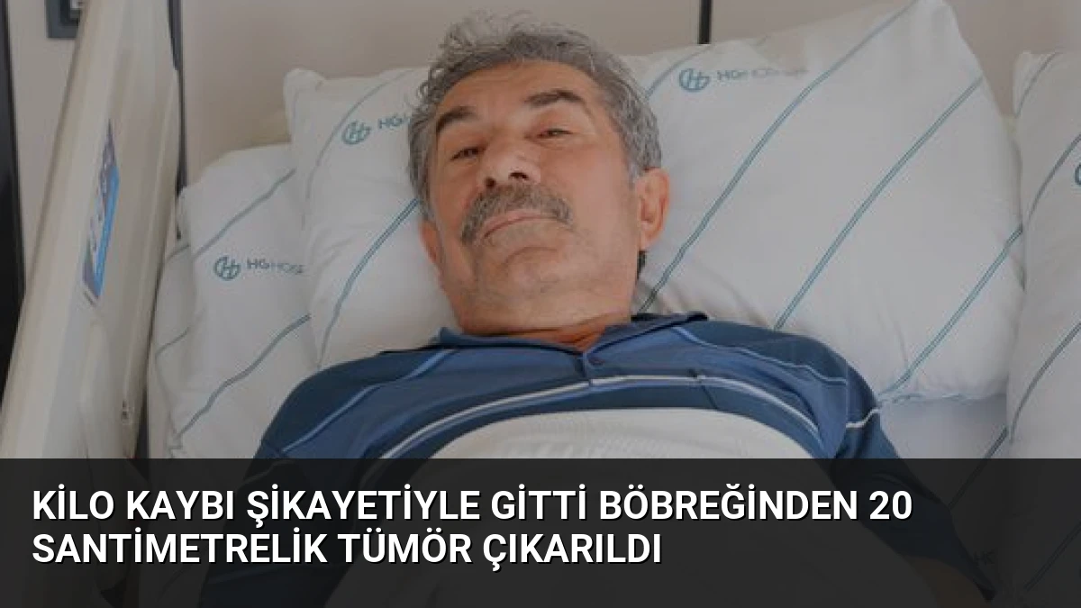 Kilo Kaybı Şikayetiyle Gitti Böbreğinden 20 Santimetrelik Tümör Çıkarıldı