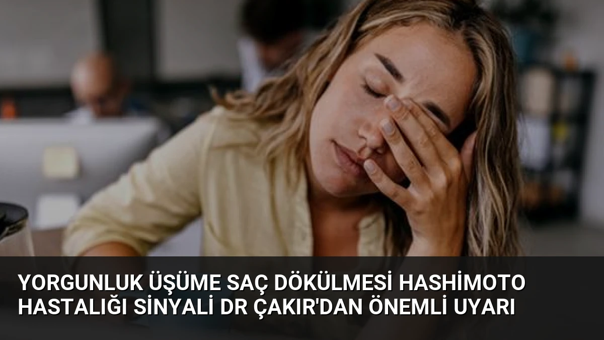 Yorgunluk Üşüme Saç Dökülmesi Hashimoto Hastalığı Sinyali Dr Çakır’dan Önemli Uyarı