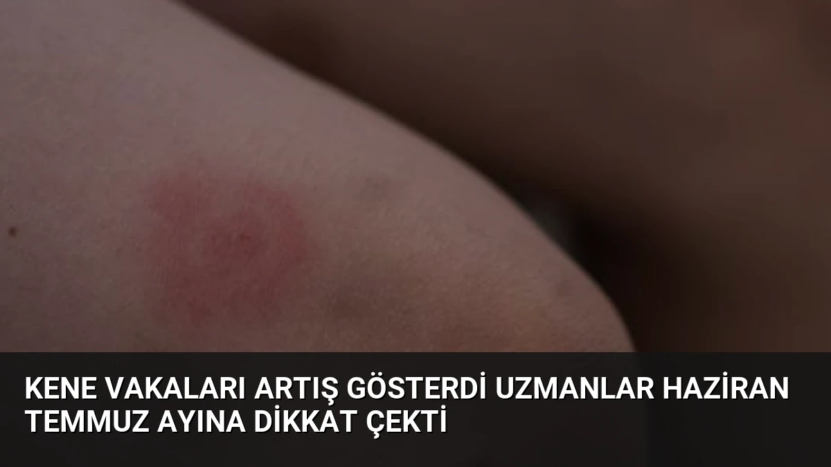 Kene Vakaları Artış Gösterdi Uzmanlar Haziran Temmuz Ayına Dikkat Çekti