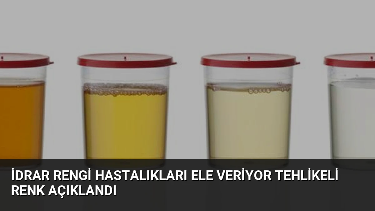 İdrar Rengi Hastalıkları Ele Veriyor Tehlikeli Renk Açıklandı